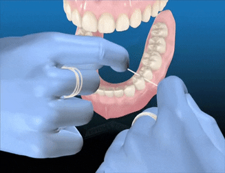 Debes usarlo en todas las caras de tus dientes frontales y posteriores.